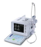 Ultrasound System (KTC01-US908)